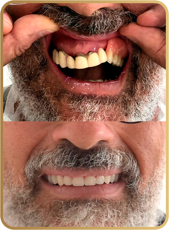 Antes e depois cliente 03