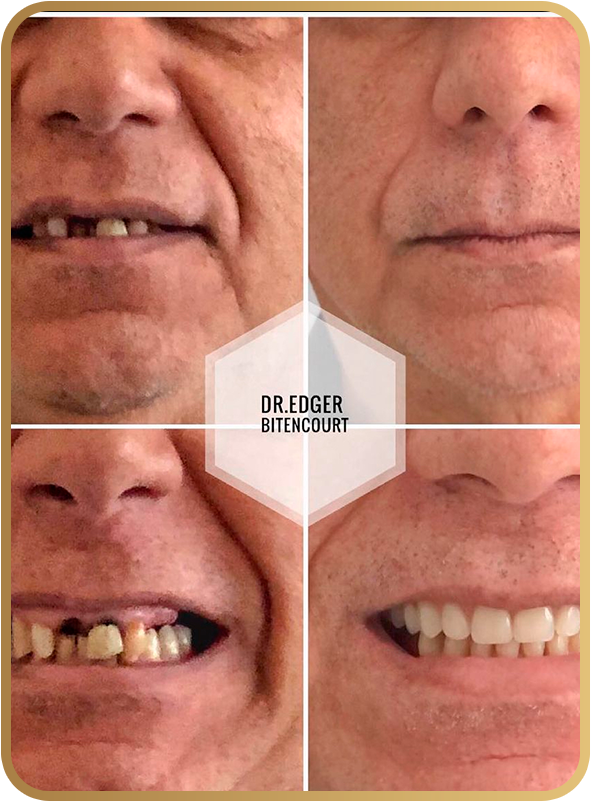 Antes e depois cliente 04