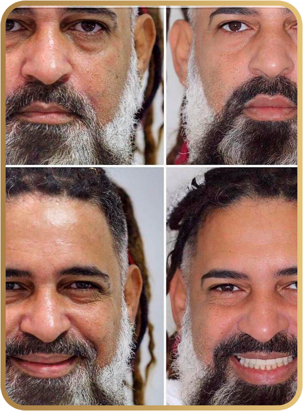 Antes e depois cliente