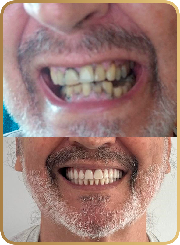 Antes e depois cliente 02